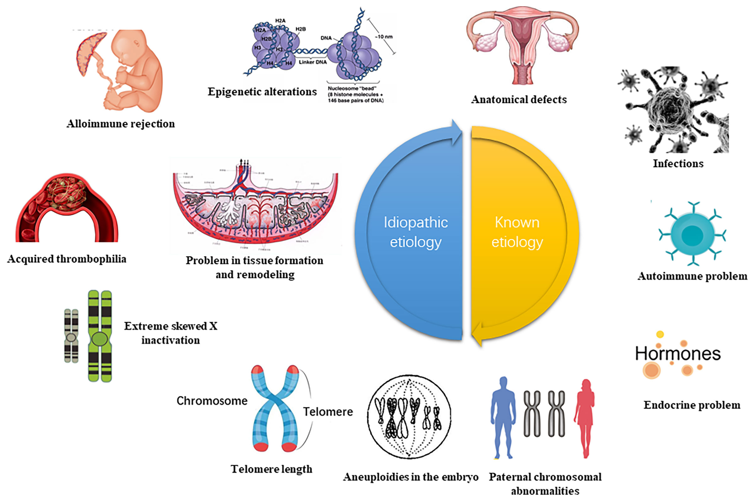 How to Fix Recurrent Miscarriage